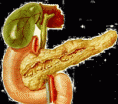 Pancreatite Aguda